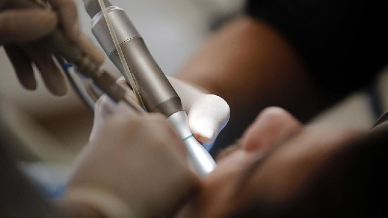 Domani l'autopsia sul paziente deceduto a Brescia